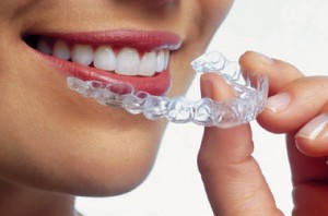 //www.smiileplease.com/wp-content/uploads/2019/02/invisalign-aligner-300x198.jpg