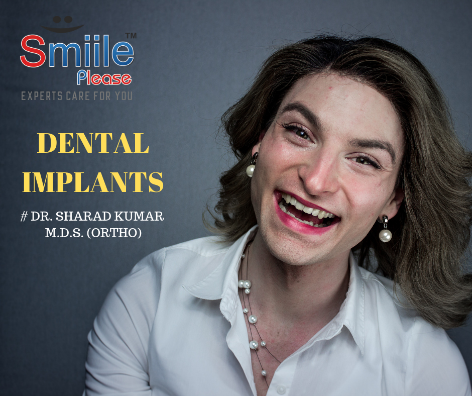 dental implants at Smile Please Dental Clinic