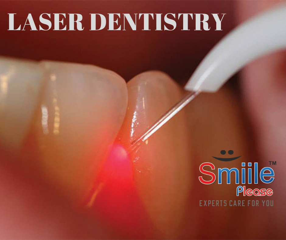 BEST DENTAL CLINIC IN VASHI WITH LASER TREATMENTS AVAILABLE. SMILE PLEASE DENTAL CLINIC VASHI, BEST BRACES.