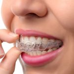 invis, best Invisalign dentist near me