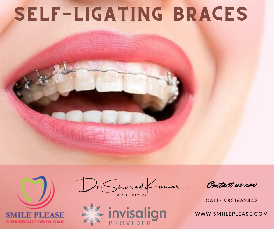 BEST BRACES IN NAVI MUMBAI