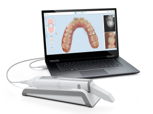 get free intra oral scan. done. at smile please. dental clinic