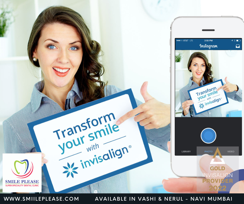 best offers on Invisalign at smile please