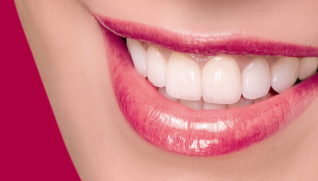 Braces for Adults
