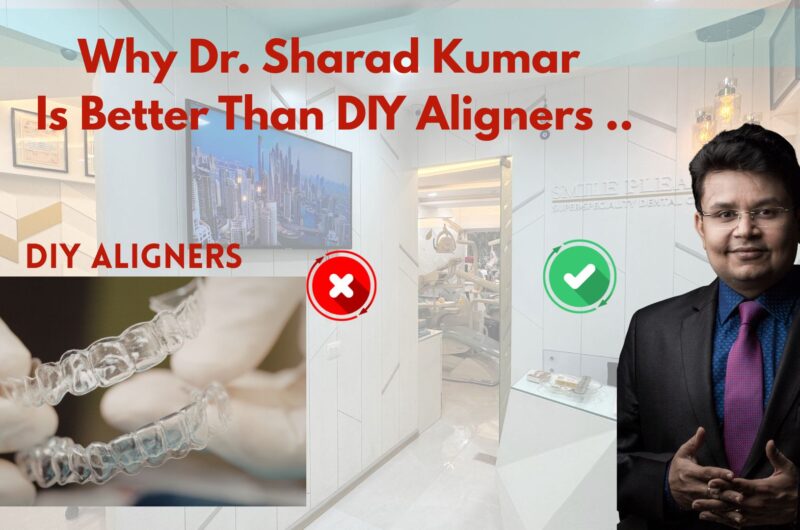 Why Dr. Sharad Kumar Is Better Than DIY Aligners